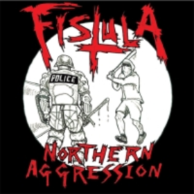 Northern Aggression Fistula