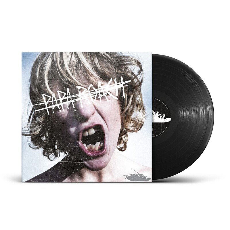 Crooked Teeth